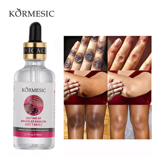 🧴 KORMESIC – Sérum Correcteur des Zones Sombres