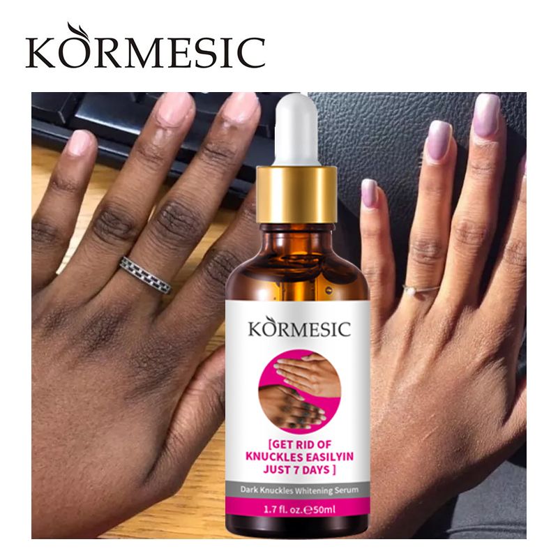 🧴 KORMESIC – Sérum Correcteur des Zones Sombres